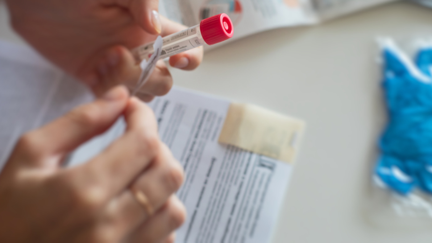 The Gold Standard Why Venous Blood Tests Remain Essential for Accurate