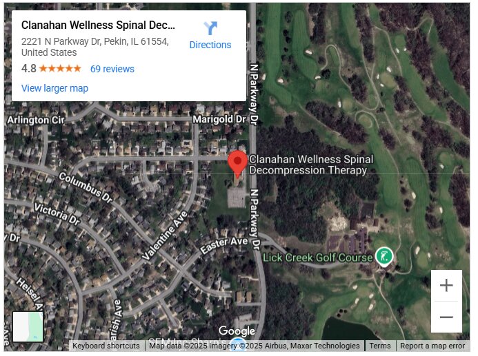 Clanahan Wellness Spinal Decompression Therapy
