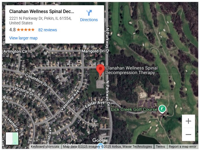 Clanahan Wellness Spinal Decompression Therapy