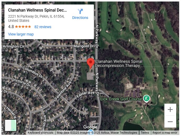 Clanahan Wellness Spinal Decompression Therapy