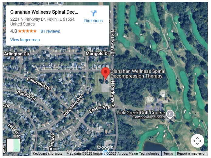 Clanahan Wellness Spinal Decompression Therapy