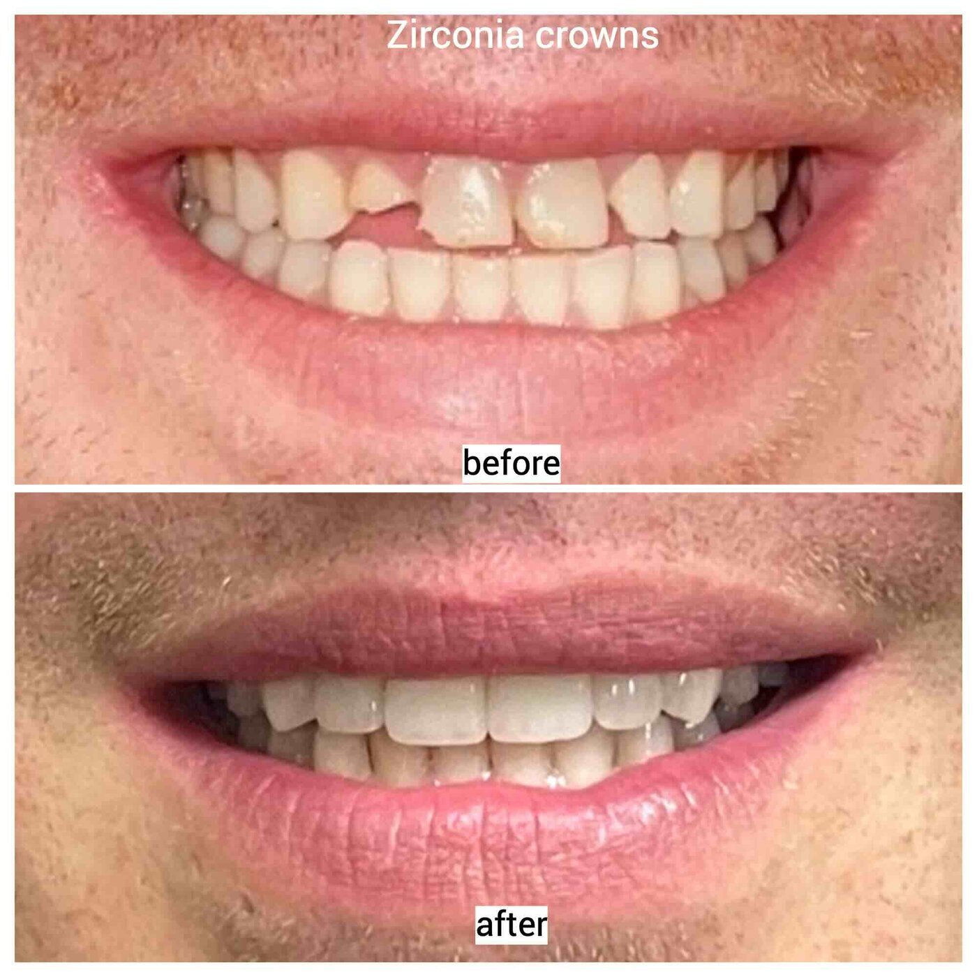 Smile Avenue Dental Group