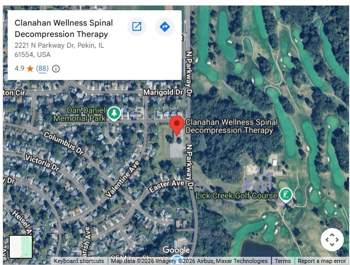 Clanahan Wellness Spinal Decompression Therapy