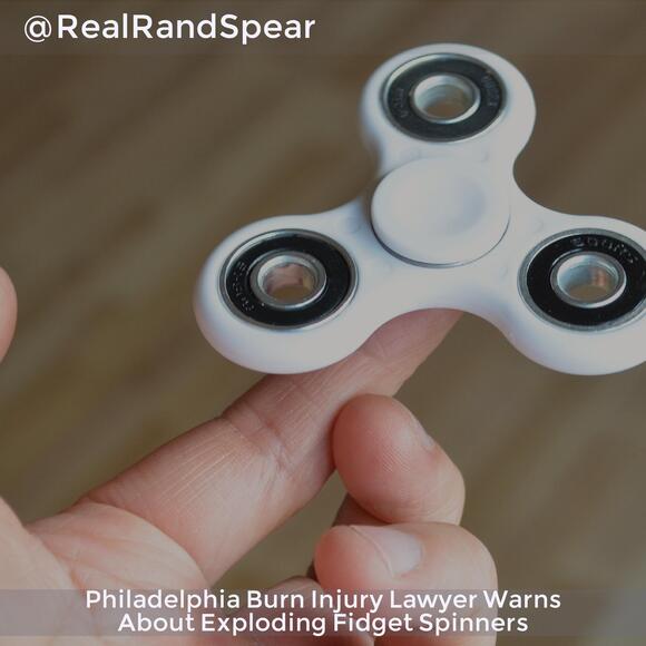 Philadelphia Burn Injury Lawyer Warns About Exploding Fidget Spinners