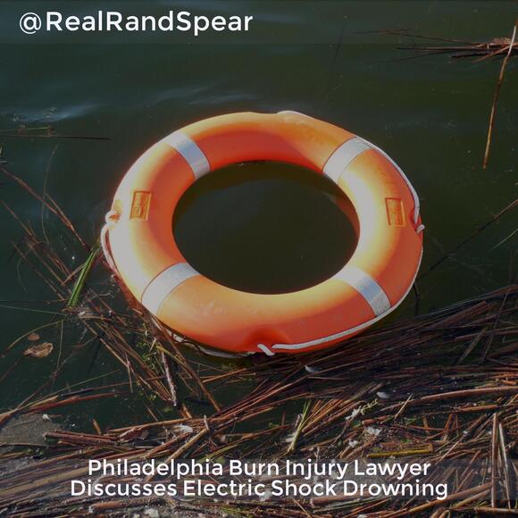 Philadelphia Burn Injury Lawyer Discusses Electric Shock Drowning