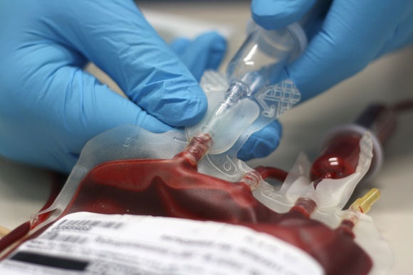 Med Mal attorney Jonathan C. Reiter explains the seriousness of blood transfusion mistakes and medical malpractice.