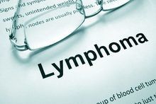 What you should know about lymphoma misdiagnosis