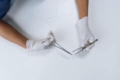 Bunion Removal: Causes, Surgery, Recovery - Northwest Surgery Center