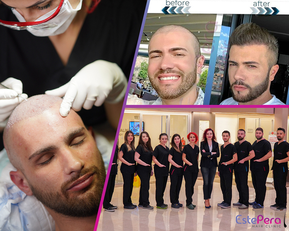 Hair Transplant in Turkey: Why is it popular and preferred? - Estepera Hair Clinic Istanbul