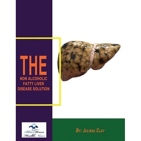 The Non Alcoholic Fatty Liver Disease Solution Reviews: Is the Liver Disease System Really Effective? By Nuvectramedical