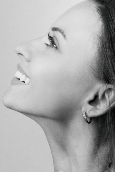 6 Reasons Why Kybella is So Special