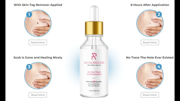 Amarose Skin Tag Remover Reviews - Is this work for Warts? Amarose Skin Tag Remover Scam or Legit?
