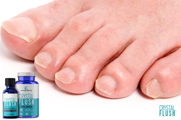 Crystal Flush Antifungal Experts explain the importance of treating toenail fungus during winter.