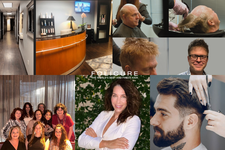 Top Reasons Why Folicure is the Best Dallas Hair Replacement Solution - No Surgery Alternative for Men and Women