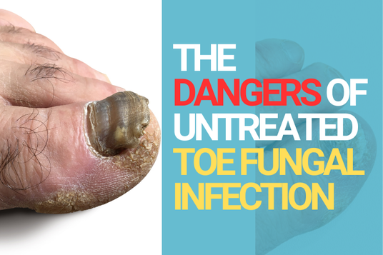 Crystal Flush Antifungal Experts Share the Dangerous Consequences Of Ignoring Toe Fungus