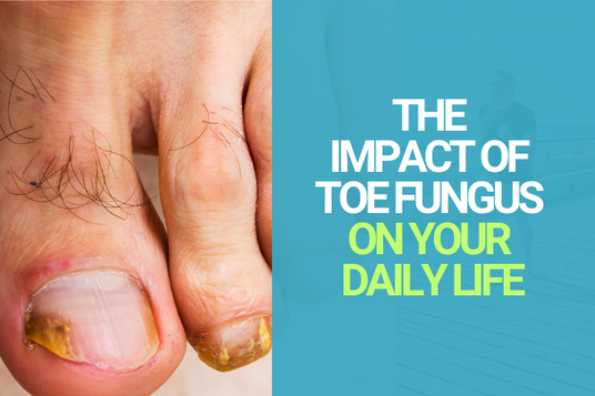 Antifungal Brand Crystal Flush Discusses the Impact of Toe Fungus on Your Daily Life