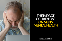 The Impact of Hair Loss on Men's Mental Health (And How to Cope)