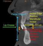 Pikos Institute Introduces Two-Tier Full Arch Implant Course Pathway for Clinicians