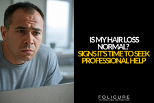Is My Hair Loss Normal? Signs It’s Time to Seek Professional Help