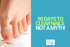 Why Toe Fungus Treatment Needs a 90-Day Protocol A Clear Look at the Crystal Flush 2-Step System