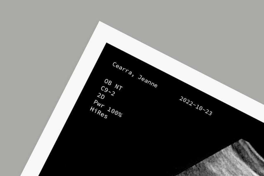 Fake Pregnancy Pranks Spark 75,000 Sales Creating a Million Dollar Trend