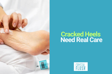 Cracked Foot Treatment: How Crystal Flush Clinical Foot Repair Helps