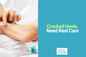 Cracked Foot Treatment: How Crystal Flush Clinical Foot Repair Helps