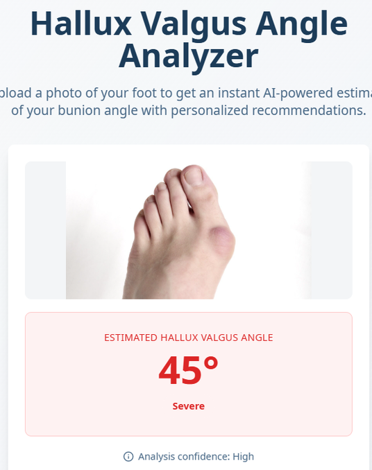 HalluxMD’s AI Transforms Foot Health for All Ages Across Generations