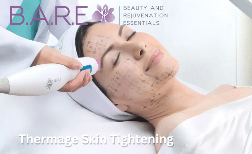 B.A.R.E. Essentials Spa Announces Exclusive Thermage Skin Tightening Access in Windsor-Essex-Tecumseh
