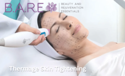 B.A.R.E. Essentials Spa Announces Exclusive Thermage Skin Tightening Access in Windsor-Essex-Tecumseh