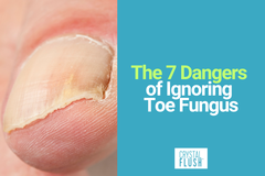 Crystal Flush Lists the 7 Dangers of Ignoring Toe Fungus