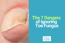 Crystal Flush Lists the 7 Dangers of Ignoring Toe Fungus
