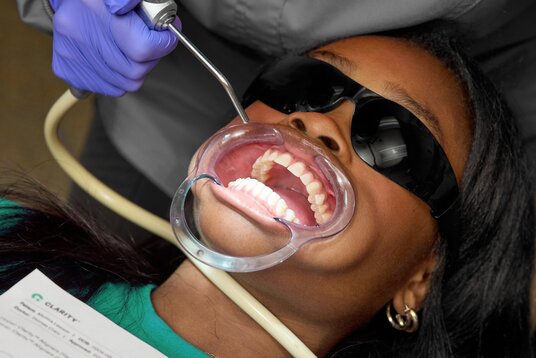 The future of clear aligners: how Clarity Aligners from Solventum can improve treatment precision