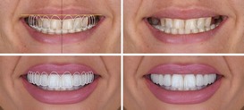 Des Moines Cosmetic Dentistry Center Introduces New Patient Guide to Comparing Cosmetic Dental Treatment Costs