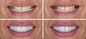 Des Moines Cosmetic Dentistry Center Introduces New Patient Guide to Comparing Cosmetic Dental Treatment Costs